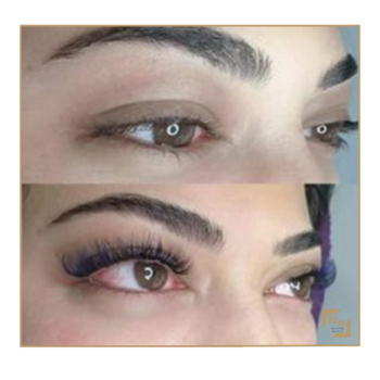 Microblading (Kıl Tekniği) Kaş