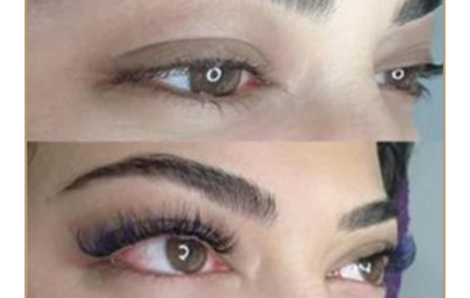 Microblading (Kıl Tekniği) Kaş